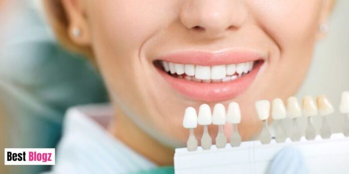 Dental Implants Everything You Need to Know